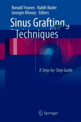 Sinus Grafting Techniques: A Step-by-Step Guide (PDF)